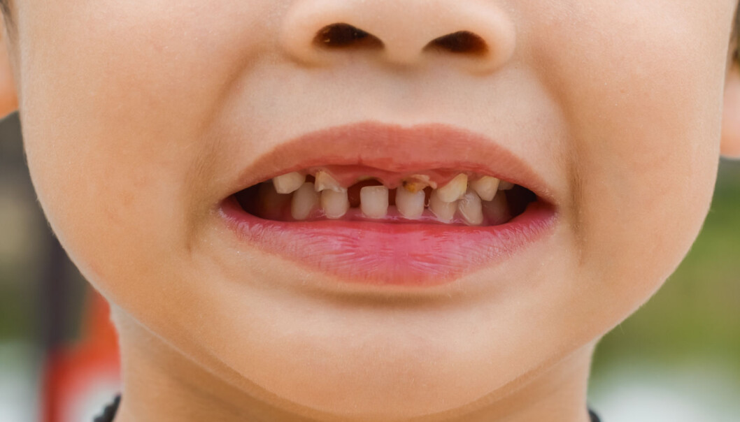 Britiske tenner kan vise seg å være like dårlige som sitt rykte (Foto: Shutterstock / NTB Scanpix) Britiske tenner kan vise seg å være like dårlige som sitt rykte (Foto: Shutterstock / NTB Scanpix)
