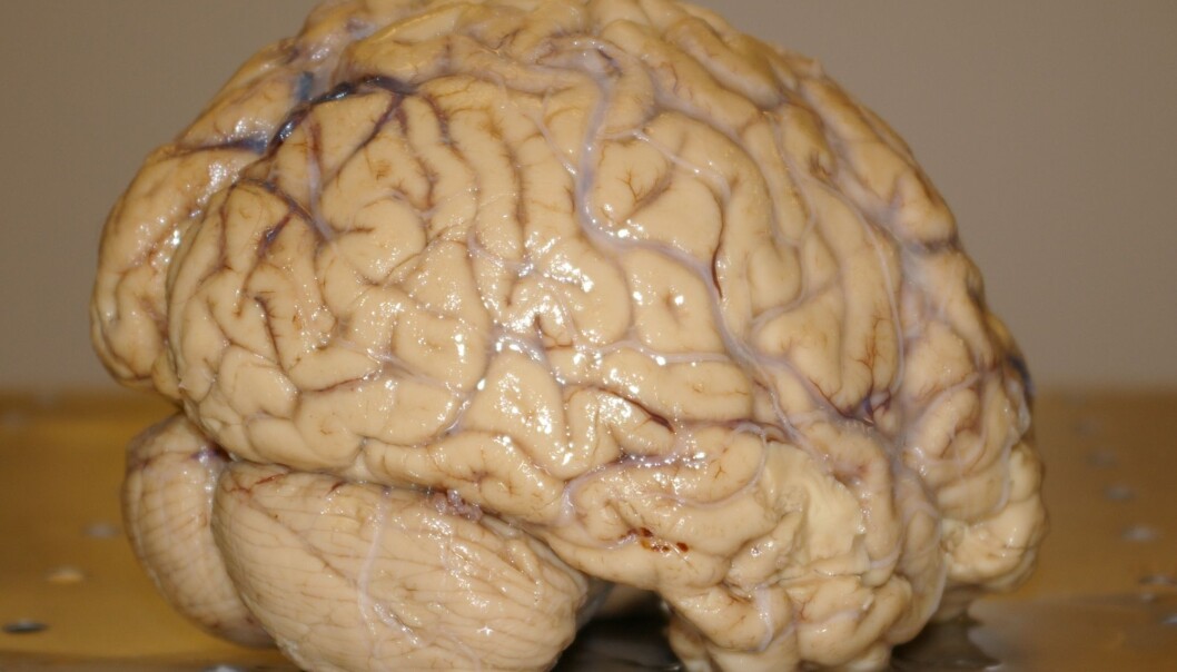 A human brain photographed at the University of Oslo (Photo: Bjørnar Kjensli) A human brain photographed at the University of Oslo (Photo: Bjørnar Kjensli)