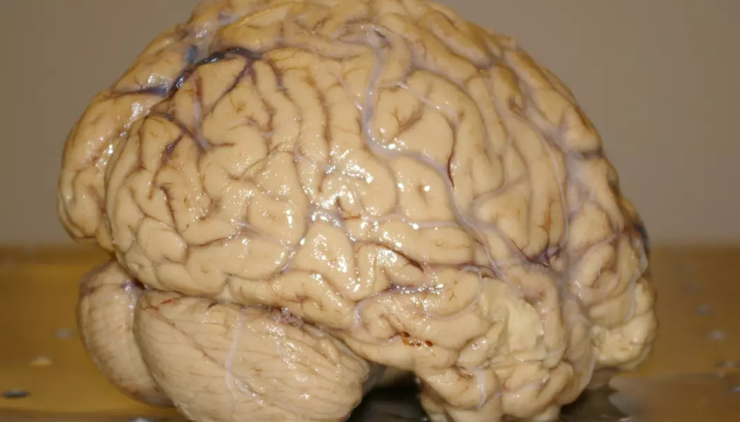 A human brain photographed at the University of Oslo (Photo: Bjørnar Kjensli)