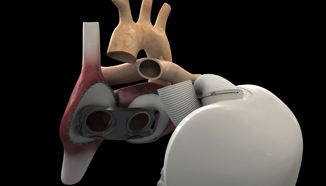 Schematic figure of the heart, showing the main blood vessels. The 'holes' indicate the two main cardiac arteries. (Illustration: Carmat) Schematic figure of the heart, showing the main blood vessels. The 'holes' indicate the two main cardiac arteries. (Illustration: Carmat)