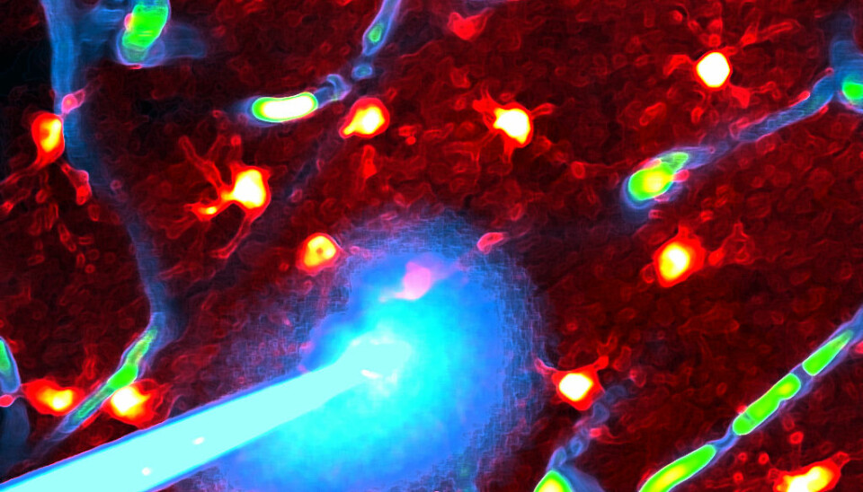 The picture shows individual glial cells deep in the brain of live mice, as well as a microelectrode used to measure electrical activity in nerve cells subjected to two-photon laser microscopy (Photo: Rangroo Thrane/Thrane, UiO).