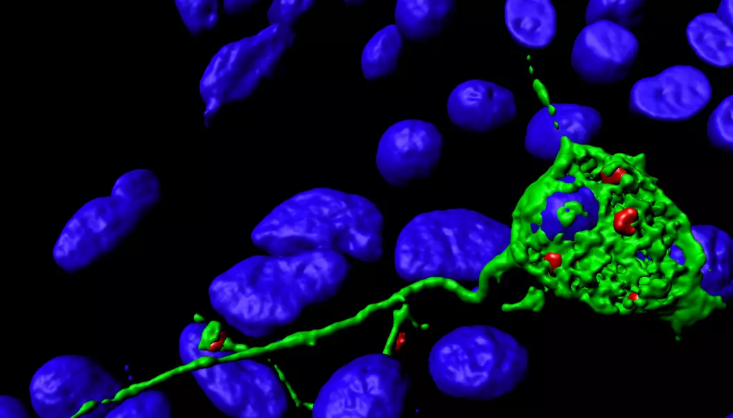 Digital rekonstruksjon av et mikroskopbilde av en nervecelle (i grønt) med lange utstikkere. Små, røde blærer har samlet seg i tuppen av trådene. De blå rundingene er cellekjerner.  (Foto: Camilla Raiborg)