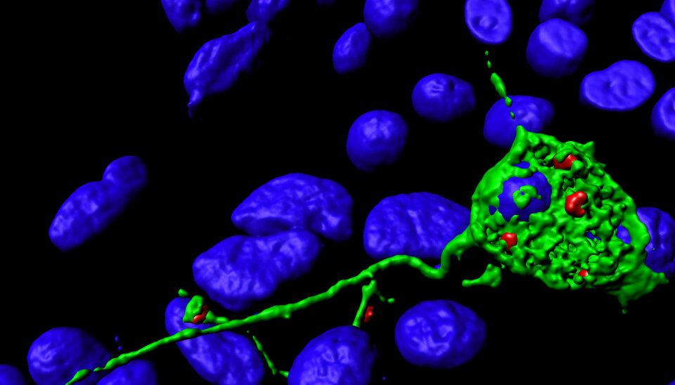 Digital rekonstruksjon av et mikroskopbilde av en nervecelle (i grønt) med lange utstikkere. Små, røde blærer har samlet seg i tuppen av trådene. De blå rundingene er cellekjerner.  (Foto: Camilla Raiborg)