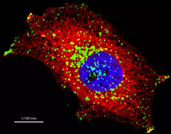 Kreftcelle fotografert i et mikroskop. Raiborg forsker på små blærer inne i cellen, her visualisert med rødt og grønt fargestoff. Cellekjernen er farget i blått. Den hvite streken viser lengden på 100 nanometer, eller en ti tusendels millimeter.  (Foto: (Foto Camilla Raiborg))