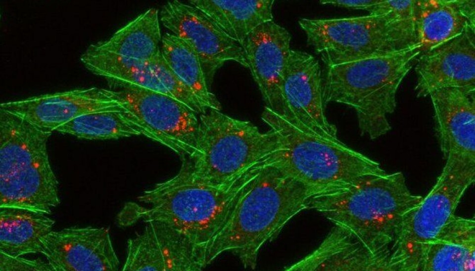 The picture shows cells that have taken up nanoparticles. The cells are green, the cell nuclei are blue and the nanoparticles are red. (Photo: Habib Baghirov, NTNU)
