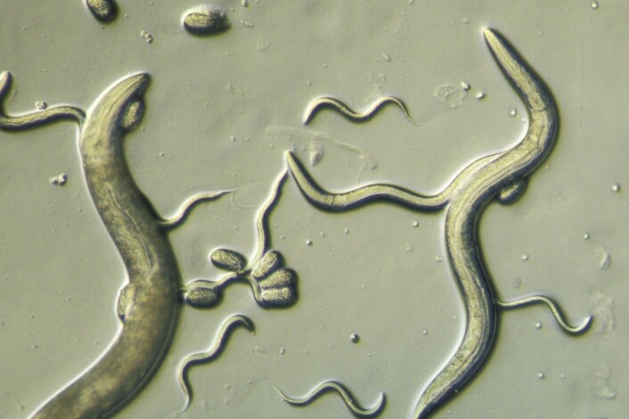 Ormen C.elegans er nyttig for forskere fordi mitokondriene likner på menneskets.
(Foto: Carolina Biological, Corbis, NTB scanpix) Ormen C.elegans er nyttig for forskere fordi mitokondriene likner på menneskets.
(Foto: Carolina Biological, Corbis, NTB scanpix)
