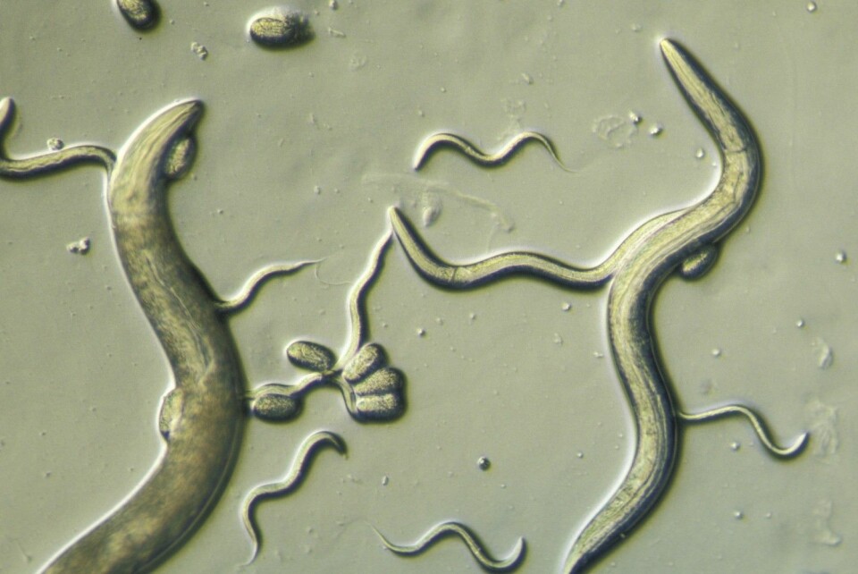 Ormen C.elegans er nyttig for forskere fordi mitokondriene likner på menneskets.
 (Foto: Carolina Biological, Corbis, NTB scanpix)