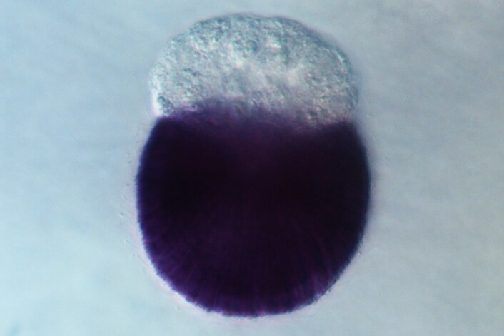 Når man skal se hvor i svampen en lncRNA er aktiv, kan man hekte farge på RNA-et for å se det bedre. Svampen er vanligvis beige, men for å se det aktive lncRNA-et bedre kan man farge dem. (Foto: Jon Bråte)