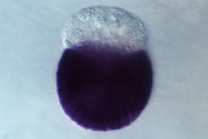Når man skal se hvor i svampen en lncRNA er aktiv, kan man hekte farge på RNA-et for å se det bedre. Svampen er vanligvis beige, men for å se det aktive lncRNA-et bedre kan man farge dem. (Foto: Jon Bråte) Når man skal se hvor i svampen en lncRNA er aktiv, kan man hekte farge på RNA-et for å se det bedre. Svampen er vanligvis beige, men for å se det aktive lncRNA-et bedre kan man farge dem. (Foto: Jon Bråte)