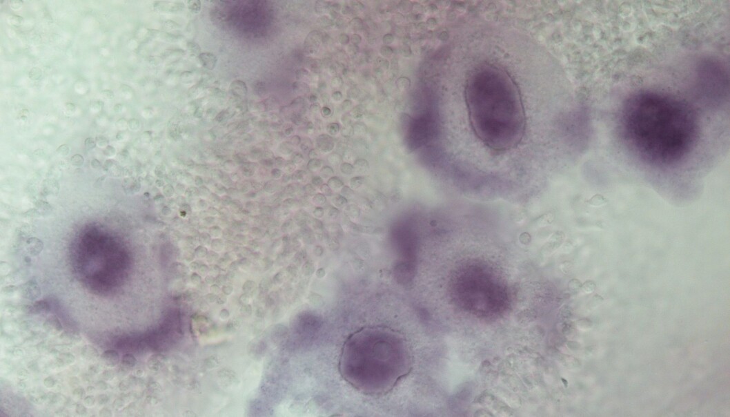For undersøke hvorfor celler begynner å samarbeide, har forskere sett på embryo-utviklingen i svamper. Her er svamper med flere embryoer inni seg. Embryoene utvikler seg til larver som svampen føder ved å skyte dem ut av en åpning i toppen. (Foto: Ina Jungersen Andresen) For undersøke hvorfor celler begynner å samarbeide, har forskere sett på embryo-utviklingen i svamper. Her er svamper med flere embryoer inni seg. Embryoene utvikler seg til larver som svampen føder ved å skyte dem ut av en åpning i toppen. (Foto: Ina Jungersen Andresen)