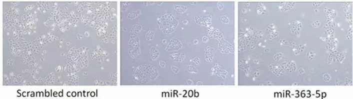 Mikroskopbilder: Bildet lengst til venstre viser hvordan kreftcellene vokser fritt og øker i mengde. De to neste bildene viser hva som skjer med veksten når cellene tilsettes to ulike typer mikroRNA-molekyler. Veksten avtar og framstår mer kontrollert. &#13;
 (Foto: Cuong Khuu, OD/UiO)