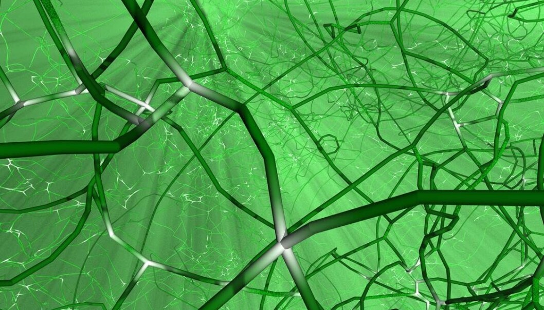 A glimpse of a dented material re-created at atomic level with the aid of mathematical modelling. The “strings” are formed when we crash, and these can decide the outcome of a collision. Each string is a cross-section of a layer of atoms in which the atoms have been displaced from their ideal positions. (Illustration: Bulatov/Lawrence Livermore National Laboratory) A glimpse of a dented material re-created at atomic level with the aid of mathematical modelling. The “strings” are formed when we crash, and these can decide the outcome of a collision. Each string is a cross-section of a layer of atoms in which the atoms have been displaced from their ideal positions. (Illustration: Bulatov/Lawrence Livermore National Laboratory)