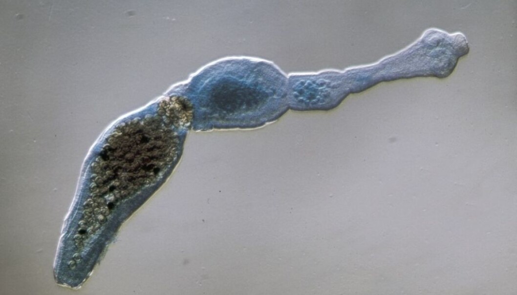 The dwarf tapeworm is the third most prevalent parasite in the world infecting humans via the food chain. (Photo: Scanpix/Science Photo Library) The dwarf tapeworm is the third most prevalent parasite in the world infecting humans via the food chain. (Photo: Scanpix/Science Photo Library)
