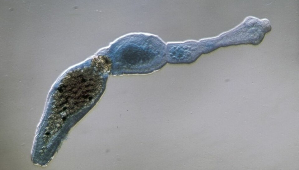 The dwarf tapeworm is the third most prevalent parasite in the world infecting humans via the food chain. (Photo: Scanpix/Science Photo Library)