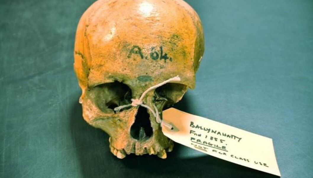 Hodeskallen til en 5200 år gammel kvinne som skal ha levd i Belfast-området i Irland. (Foto: Daniel Bradley, Trinity College Dublin) Hodeskallen til en 5200 år gammel kvinne som skal ha levd i Belfast-området i Irland. (Foto: Daniel Bradley, Trinity College Dublin)