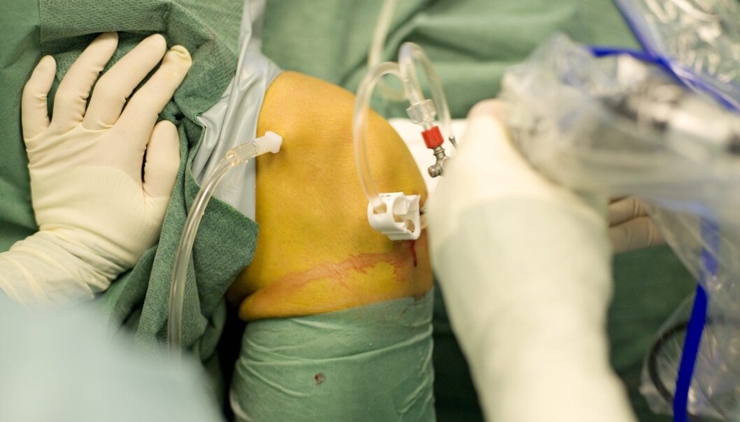 Studier viser at opptrening av kneskader har minst like godt effekt som kirurgi. Likevel belastes helsesystemet med operasjoner. (Foto: Mikkel Østergaard, Samfoto, NTB scanpix) Studier viser at opptrening av kneskader har minst like godt effekt som kirurgi. Likevel belastes helsesystemet med operasjoner. (Foto: Mikkel Østergaard, Samfoto, NTB scanpix)
