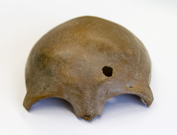 En av hodeskallene fra graven. Denne personen har sannsynligvis blitt drept av et kastespyd som har penetrert hodeskallen. (Foto: Vrije Universiteit Amsterdam)