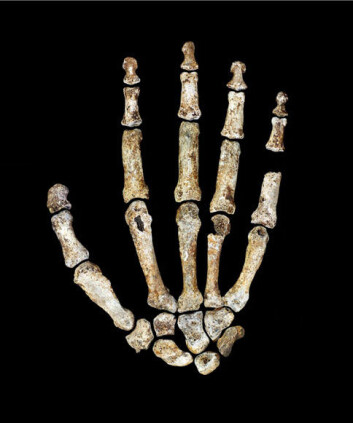 Homo naledis hånd er påfallende lik våre hender. (Foto: Kivell, T.L et al.) Homo naledis hånd er påfallende lik våre hender. (Foto: Kivell, T.L et al.)