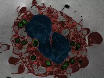 An immune-system cell dies from Yersinia pestis infection. The cell membrane blisters and the cell’s nucleus mutates. Green: Bacteria. Red: Cell contents. Blue: Nucleus. (Photo: Weng et al. PNAS 2014, 111:7391)