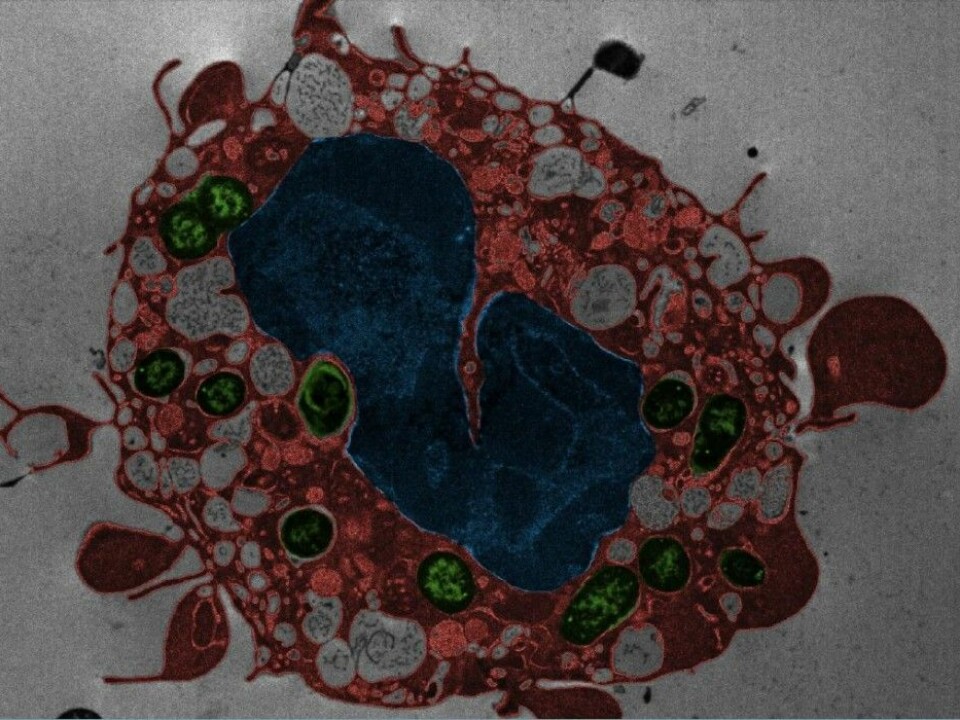 An immune-system cell dies from Yersinia pestis infection. The cell membrane blisters and the cell’s nucleus mutates. Green: Bacteria. Red: Cell contents. Blue: Nucleus. (Photo: Weng et al. PNAS 2014, 111:7391)