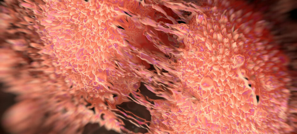 Defekter i celledelingen kan ha betydning for kreftutvikling. Her er to prostatakreftceller i siste fase av celledelingen. (Foto: Shutterstock)