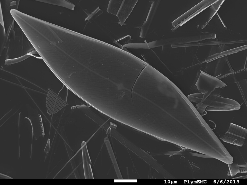 A microphotograph of sea-ice diatoms (Pleurosigma stuxbergii), which produces the chemical fossil that scientists study to describe the extent of sea ice in the Arctic. (Photo: Thomas A. Brown and Simon T. Belt)