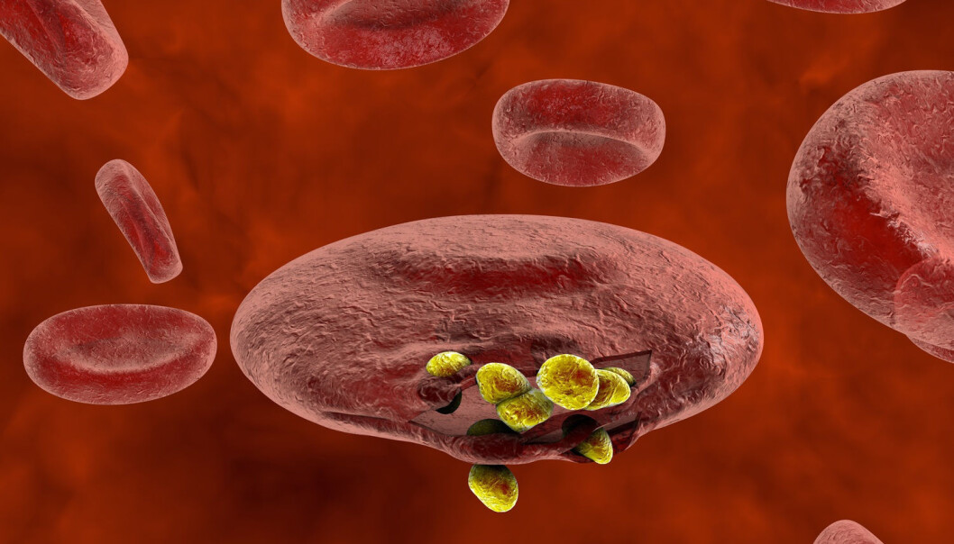 Malariaparasitten Plasmodium, her tegnet i gult, tyter ut fra en infisert blodcelle. (Illustrasjon: Shutterstock) Malariaparasitten Plasmodium, her tegnet i gult, tyter ut fra en infisert blodcelle. (Illustrasjon: Shutterstock)