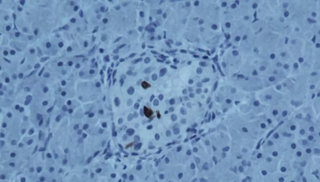 The dark patches are viral components in the insulin-producing cells in the islets of Langerhans. (Photo: DiViD)