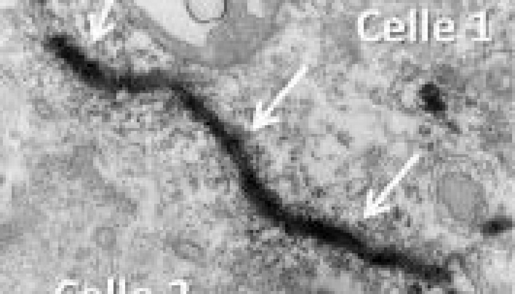 Image 1: The mutant CEL-protein has aggregated, the arrows showing how it aligns at the membrane between two cells. (Photo: Bente B. Johansson, The Molecular Imaging Centre (MIC), UiB) Image 1: The mutant CEL-protein has aggregated, the arrows showing how it aligns at the membrane between two cells. (Photo: Bente B. Johansson, The Molecular Imaging Centre (MIC), UiB)