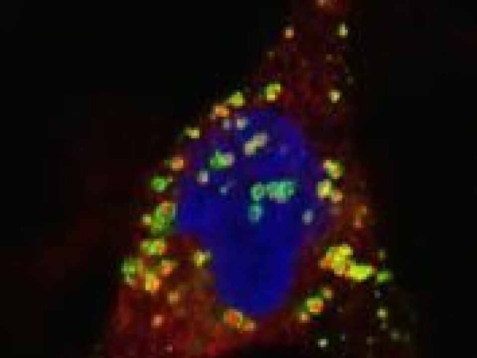 Image 2: A cell that has absorbed mutant CEL-protein. The protein has been visualized as red dots surrounded by a green membrane. (Photo: Janniche Torsvik, The Molecular Imaging Centre (MIC), UiB)