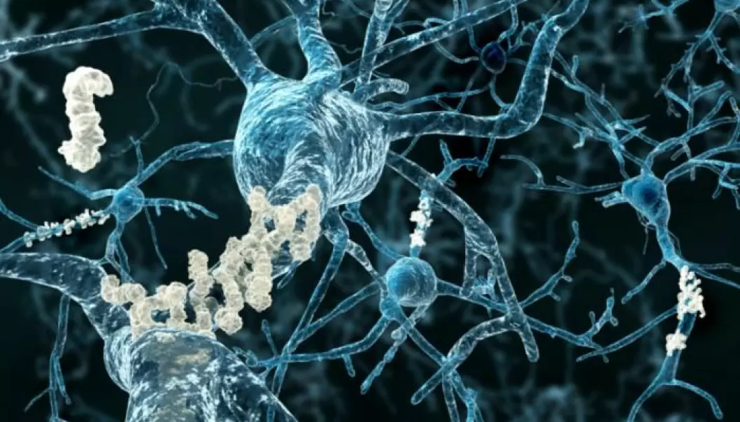 Alzheimers sykdom oppstår ved at et protein avleires som klebrige klumper i hjernen. Nå viser en studie at sakte gange kan være et tidlig tegn.  (Foto: Neurology)