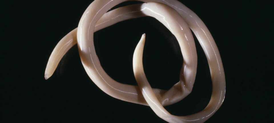 Denne ormen, Ascaris lumbricoides, kan bli hele 36 centimeter lang. (Illustrasjonsfoto: Science Photo Library)
