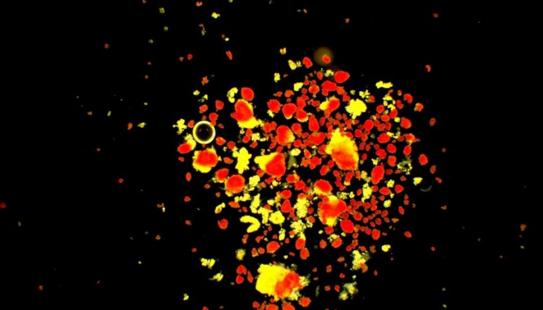 Hand-picked beta cells from the islets of Langerhans in the pancreas. (Photo: Oskar Skog, Uppsala University)