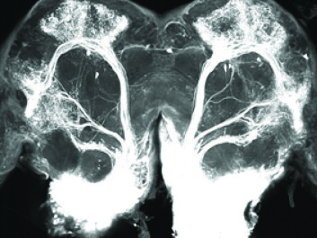 The white areas at the bottom of the photo are the male moth’s primary smell processing centre. The white structures at the top of the image are important for learning and memory. If the insect finds nutritious food, an olfactory memory is established so that the insect can later locate food. (Illustration: NTNU) The white areas at the bottom of the photo are the male moth’s primary smell processing centre. The white structures at the top of the image are important for learning and memory. If the insect finds nutritious food, an olfactory memory is established so that the insect can later locate food. (Illustration: NTNU)