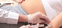 Enkel blodprøve av gravide kan avsløre flere syndromer