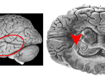 These two pictures show the human brain. The area that is called the amygdala is marked with a circle and arrow. Data from the amygdala is similar to what NTNU researchers have found in the moth’s lateral horn. (Illustration: NTNU) These two pictures show the human brain. The area that is called the amygdala is marked with a circle and arrow. Data from the amygdala is similar to what NTNU researchers have found in the moth’s lateral horn. (Illustration: NTNU)