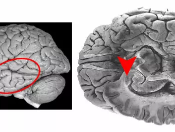 These two pictures show the human brain. The area that is called the amygdala is marked with a circle and arrow. Data from the amygdala is similar to what NTNU researchers have found in the moth’s lateral horn. (Illustration: NTNU)