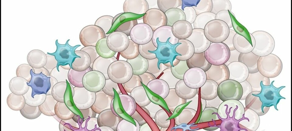 Ein kreftsvulst er ikkje berre ein klump av farlege kreftceller (kulerunde celler), men inneheld også andre celletypar, slik som blodårer (raude), immunceller (blå, turkis og lilla) og celler frå bindevevet (grøne). (Illustrasjon: Frå:  Junttila mfl: Influence of tumour micro-environment heterogeneity on therapeutic response, Nature 2013)