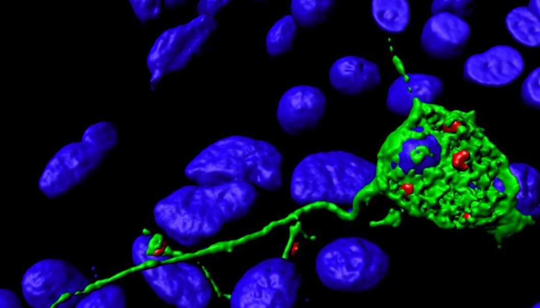 Microscopy image of a neuron (green). Vesicles (red) gather at the tips of the nerve fibres before fusing with the cell membrane and contributing to further growth of the nerve fibre. Cell nuclei (DNA) can be seen in blue. (Photo: Camilla Raiborg, CCB) Microscopy image of a neuron (green). Vesicles (red) gather at the tips of the nerve fibres before fusing with the cell membrane and contributing to further growth of the nerve fibre. Cell nuclei (DNA) can be seen in blue. (Photo: Camilla Raiborg, CCB)