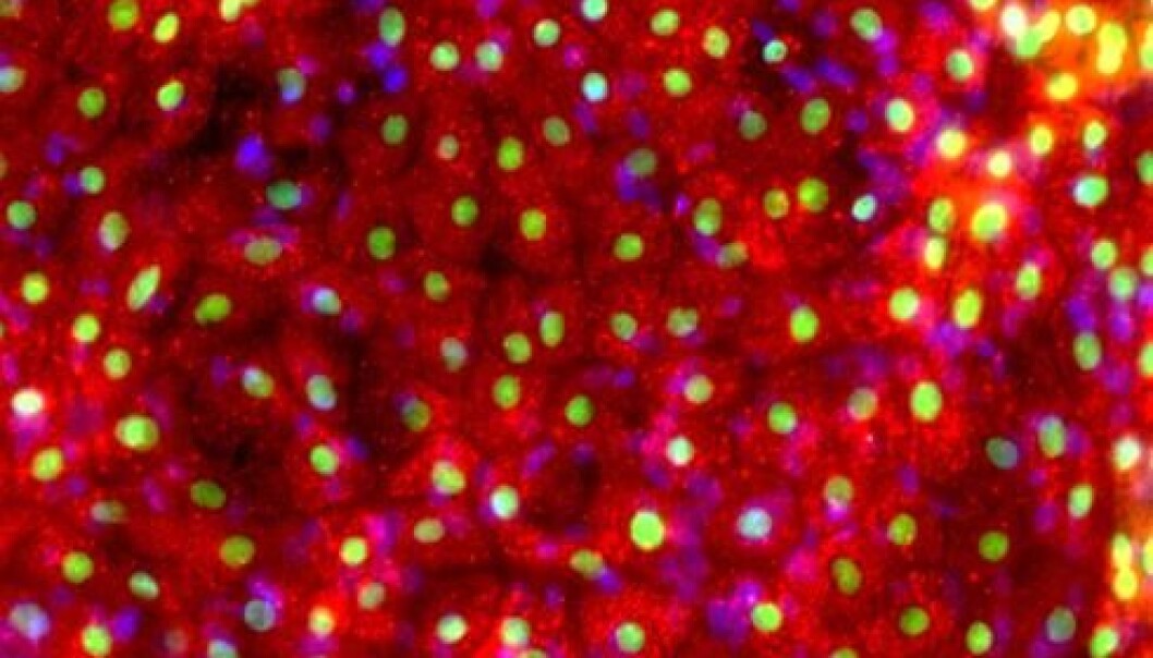 Synthetic liver cells produced using small molecules. The method is both robust and cost-effective. (Photo: Gareth Sullivan) Synthetic liver cells produced using small molecules. The method is both robust and cost-effective. (Photo: Gareth Sullivan)