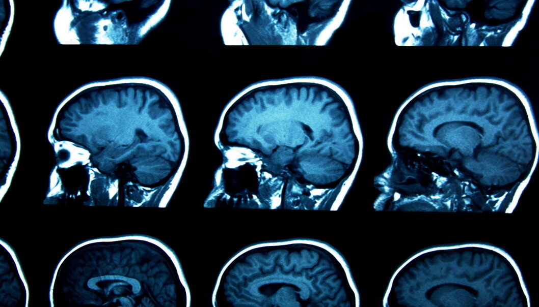 Nevropsykologi er den delen av det psykologifaget som tar for seg sammenhengene mellom hjerne og atferd. Det betyr at man med utgangspunkt i hjernen kan forutsi hvordan vi vil reagere på ulike situasjoner. (Illustrasjon: Microstock) Nevropsykologi er den delen av det psykologifaget som tar for seg sammenhengene mellom hjerne og atferd. Det betyr at man med utgangspunkt i hjernen kan forutsi hvordan vi vil reagere på ulike situasjoner. (Illustrasjon: Microstock)