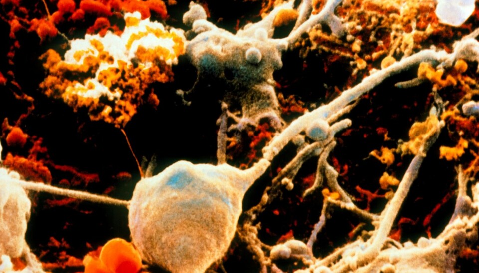 Bildet viser celler i hjernen. Nervecellene er de store som her er farget grå. Gliacellene har fått en oransj farge. Gliacellenes funskjon i hjerne har lenge vært undervurdert, men nå lurer forskerne på om de kan lage bedre epilepsimedisin ved å rettet behandlingen mot denne typen av celler også. (Illustrasjonsfoto: Science Photo Library)