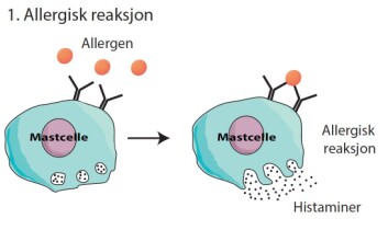 Allergiske reaksjoner forekommer når allergener kommer i kontakt med molekyler på overflaten av bestemte immunceller (mastceller). Dette fører til at mastcellene frigjør histaminer som gir allergiske symptomer. (Foto: (Illustrasjon: UiO)) Allergiske reaksjoner forekommer når allergener kommer i kontakt med molekyler på overflaten av bestemte immunceller (mastceller). Dette fører til at mastcellene frigjør histaminer som gir allergiske symptomer. (Foto: (Illustrasjon: UiO))