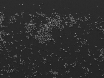 The photo shows bacteria to which Thiophenone has been added. The pictures show clearly the significant difference in the amount of biofilm the bacteria form with and withough the addition of Thiophenone. (Photo: Steinar Stølen) The photo shows bacteria to which Thiophenone has been added. The pictures show clearly the significant difference in the amount of biofilm the bacteria form with and withough the addition of Thiophenone. (Photo: Steinar Stølen)