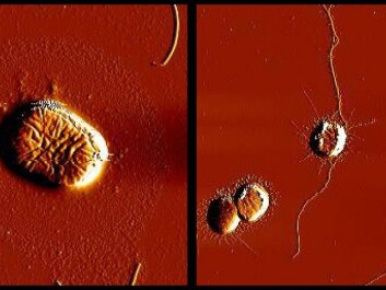 TheE. coli-bacteria have genes that code for filamental structures, making it easier for the bacteria to attaching to surfaces. To the left, we see an E. coli- bacterium to which Thiophenone has been added. We can see that the threads are missing. To comparison, we see the bacteria to which Thiophenone has not been added to the right, and these bacteria have produced threads "as normal". (Photo: Ida Hegna, School of Pharmacy, UiO) TheE. coli-bacteria have genes that code for filamental structures, making it easier for the bacteria to attaching to surfaces. To the left, we see an E. coli- bacterium to which Thiophenone has been added. We can see that the threads are missing. To comparison, we see the bacteria to which Thiophenone has not been added to the right, and these bacteria have produced threads "as normal". (Photo: Ida Hegna, School of Pharmacy, UiO)