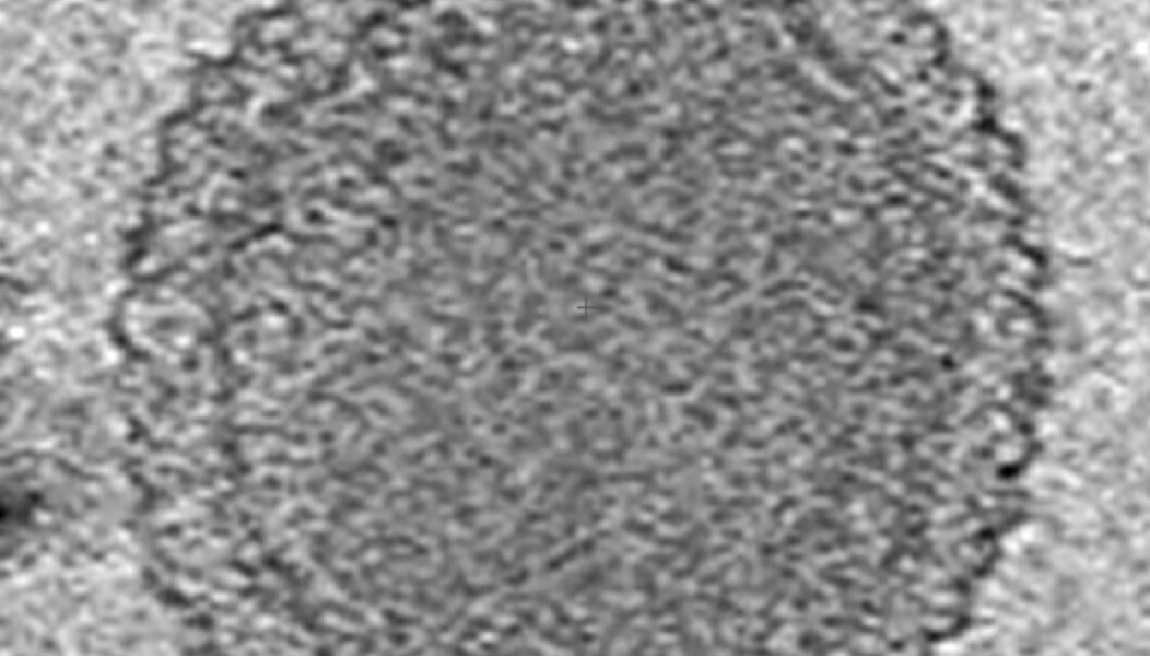 This cryogenic electron tomography image reveals the internal structure of an ultra-small bacterium. The cell has a very dense interior compartment and a complex cell wall. The image was obtained from a 3-D reconstruction. The scale bar is 100 nanometers. (Photo: Birgit Luef, UC Berkeley, NTNU) This cryogenic electron tomography image reveals the internal structure of an ultra-small bacterium. The cell has a very dense interior compartment and a complex cell wall. The image was obtained from a 3-D reconstruction. The scale bar is 100 nanometers. (Photo: Birgit Luef, UC Berkeley, NTNU)