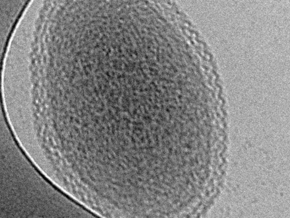 Cryogenic transmission electron microscopy image of an ultra-small bacteria cell. The scale bar is 100 nanometers. (Photo: Birgit Luef, UC Berkeley, NTNU)