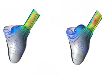 Researchers have carried out studies of both vein and valve placement, and how different valve geometries affect blood flow patterns within the heart. The illustrations demonstrate how changes in valve Researchers have carried out studies of both vein and valve placement, and how different valve geometries affect blood flow patterns within the heart. The illustrations demonstrate how changes in valve geometry alter blood flow as it leaves the heart and enters the aorta. This may be of vital importance when deciding which patients should be operated on, and which surgical procedure should be selected. (Illustration: SINTEF) Researchers have carried out studies of both vein and valve placement, and how different valve geometries affect blood flow patterns within the heart. The illustrations demonstrate how changes in valve Researchers have carried out studies of both vein and valve placement, and how different valve geometries affect blood flow patterns within the heart. The illustrations demonstrate how changes in valve geometry alter blood flow as it leaves the heart and enters the aorta. This may be of vital importance when deciding which patients should be operated on, and which surgical procedure should be selected. (Illustration: SINTEF)