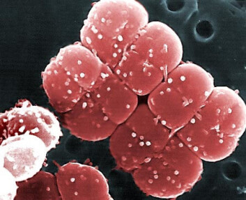 Superbakterien Deinococcus radiodurans tåler både radioaktiv stråling, ekstrem kulde, dehydrering, vakuum og gift. Den er gudskjelov ganske harmløs. Foto: Fra internett (Foto: NTB scanpix) Superbakterien Deinococcus radiodurans tåler både radioaktiv stråling, ekstrem kulde, dehydrering, vakuum og gift. Den er gudskjelov ganske harmløs. Foto: Fra internett (Foto: NTB scanpix)