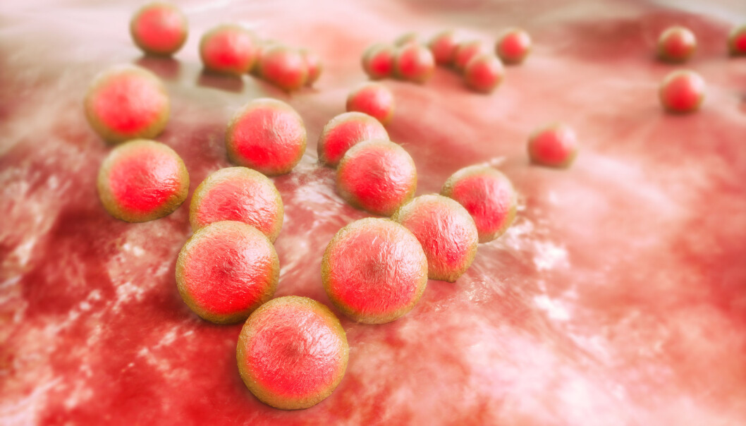 Forskere har funnet en mulig kur mot MRSA. Likevel er ikke alle leger vilt begeistret. (Illustrasjonsfoto: Microstock) Forskere har funnet en mulig kur mot MRSA. Likevel er ikke alle leger vilt begeistret. (Illustrasjonsfoto: Microstock)
